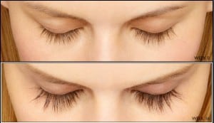 latisse-long-eyelashes-300x173