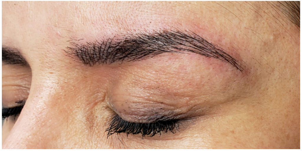 Microblading Before and After Pictures in Miami, FL