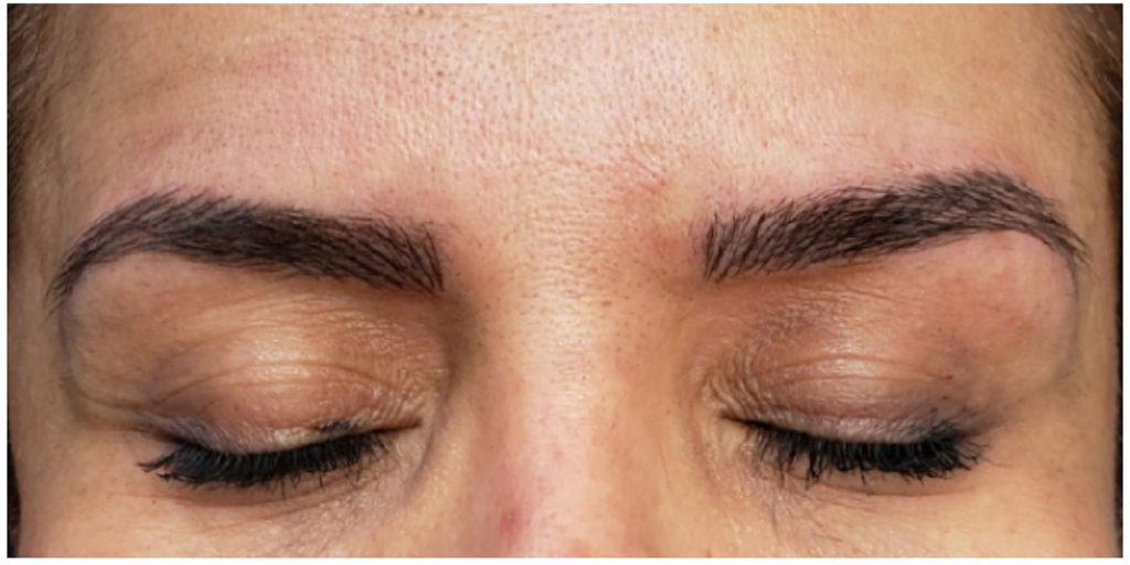 Microblading Before and After Pictures in Miami, FL