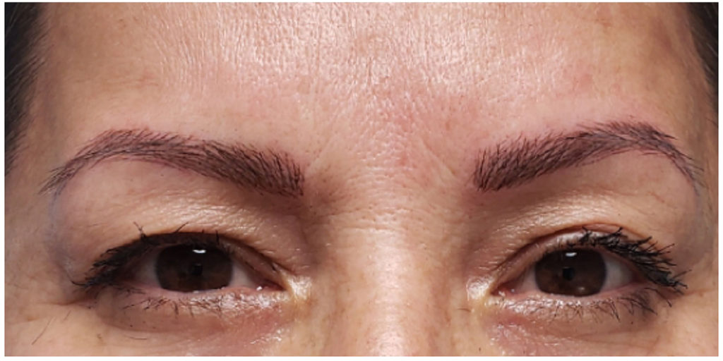 Microblading Before and After Pictures in Miami, FL