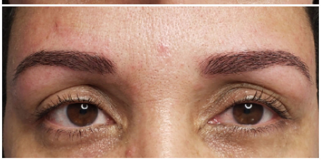 Microblading Before and After Pictures in Miami, FL