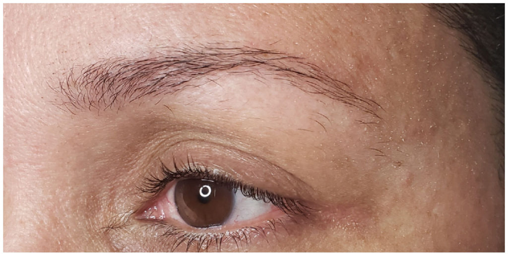 Microblading Before and After Pictures in Miami, FL