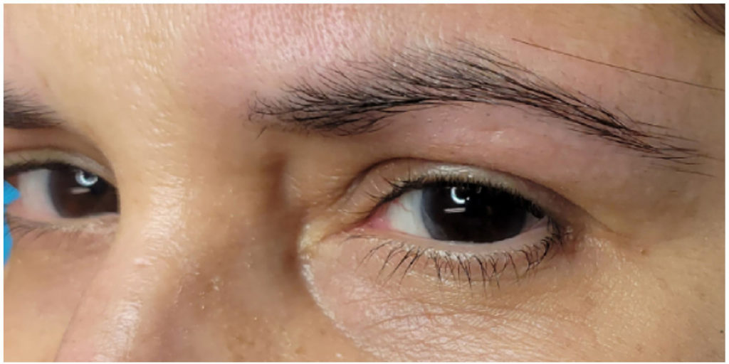 Microblading Before and After Pictures in Miami, FL