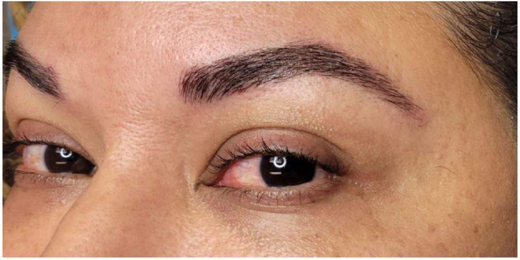 Microblading Before and After Pictures in Miami, FL