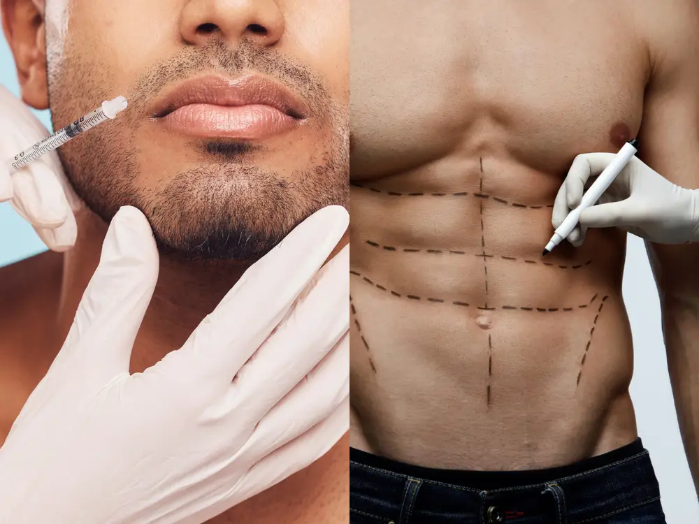 A Miami plastic surgeon reveals the top plastic surgery trends for men, including 'fake ab' surgery and buccal fat removal